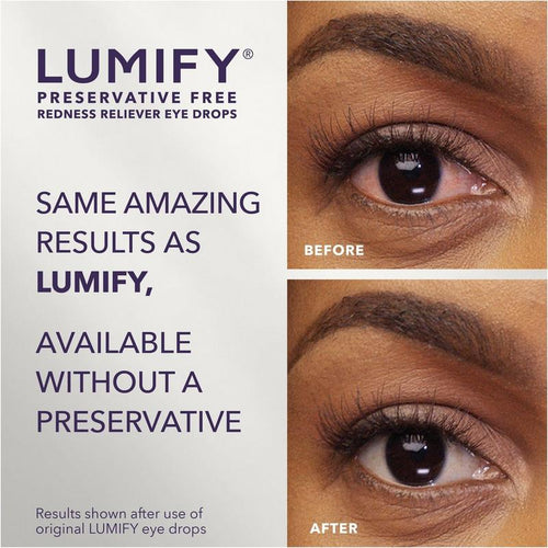 LUMIFY Redness Reliever Eye Drops